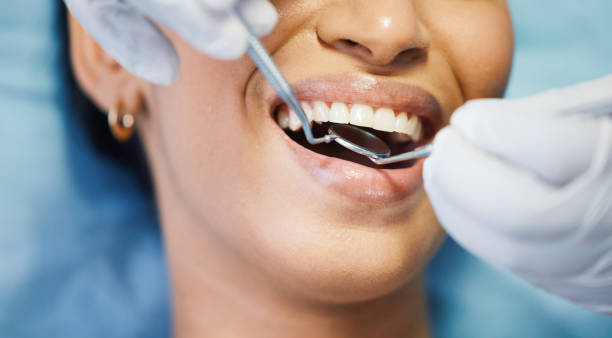 Best Broken or Cracked Tooth Emergency Dentist in North Plymouth, MA